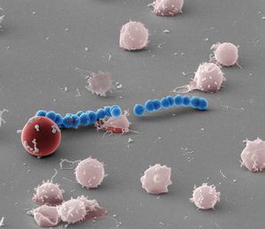 Scanning electron micrograph of red blood cell hemolysis by the Streptolysin S producing Group A Streptococcus. Credit: Shaun Lee, Dustin Higashi