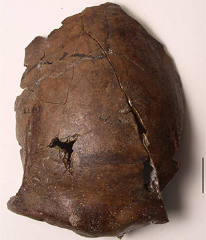 This photo shows the skull bone fragment found outside Aitape, Papua New Guinea, in 1929. The bone has been dated to be about 6,000 years old and likely belongs to the world's first known tsunami victim.